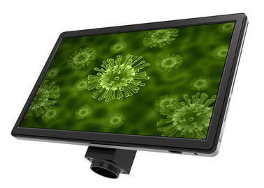Porcellana Il nero LCD dello schermo UOP XSP-16.0 di HD 16 del mp degli accessori pieni del microscopio fornitore